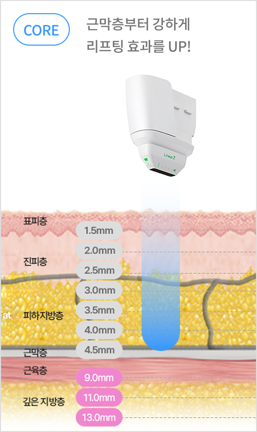 카트리지 깊이 조절로 진피층과 SMAS층을 정밀 타겟팅하는 리니어지 구조 설명 이미지