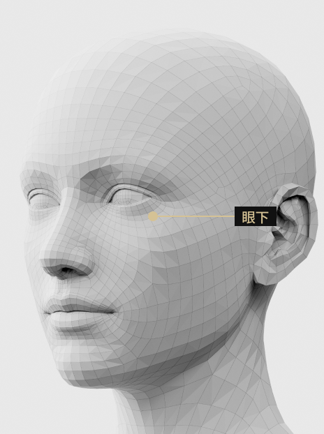 圖片描述：眼下填充劑注射部位，用於改善眼下凹陷和下垂。