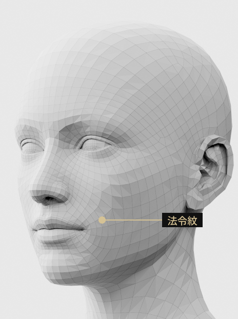 圖片描述：填充劑注射手術，用於填充法令紋，減輕臉部老化跡象。