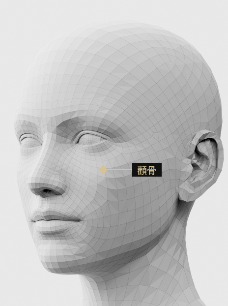 圖片顯示了填充治療如何增加顴骨的體積，從而打造立體的臉部輪廓。