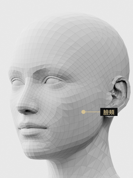 圖片展示了填充臉頰凹陷處以創造年輕容顏的填充手術過程。