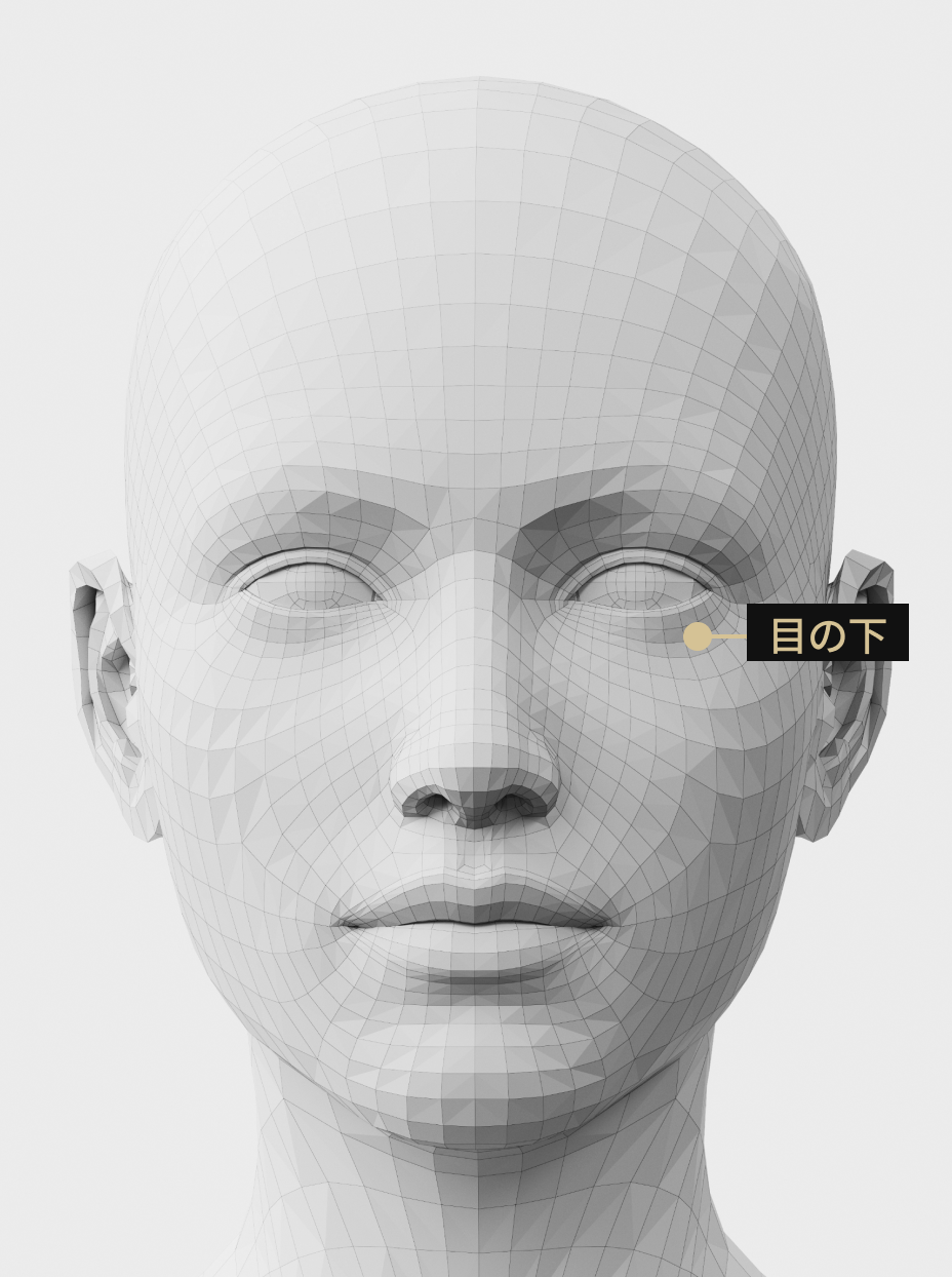 目の下のしわや弾力を改善するためのボトックス手術部位説明画像