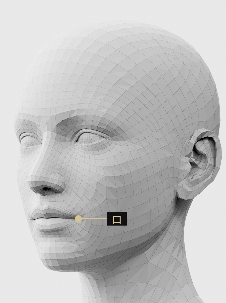 唇と口尾にボリュームを加えてスマイルラインを改善するフィラー施術イメージ