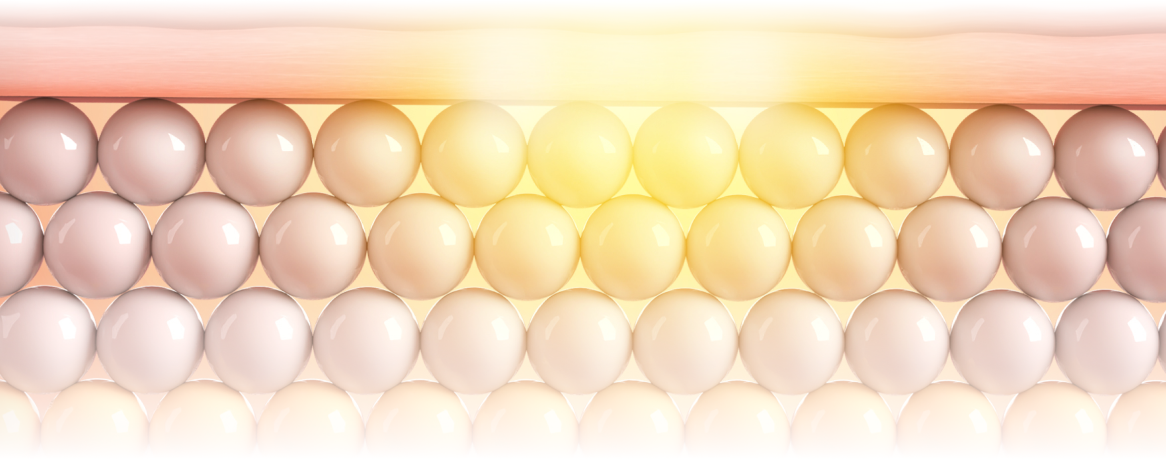 皮膚の状態に合わせて高周波エネルギーを伝達するポテンザレーザー手術コンセプトイメージ