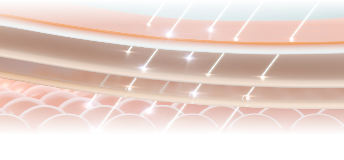 단극성 고주파 에너지가 진피층에 전달되는 과정을 시각화한 피부 단면 일러스트