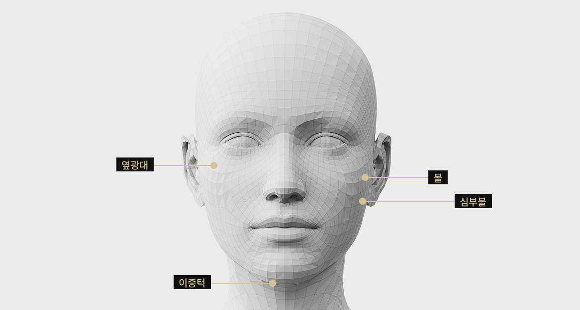 온다 리프팅 적용 부위를 표시한 3D 얼굴 모델 이미지