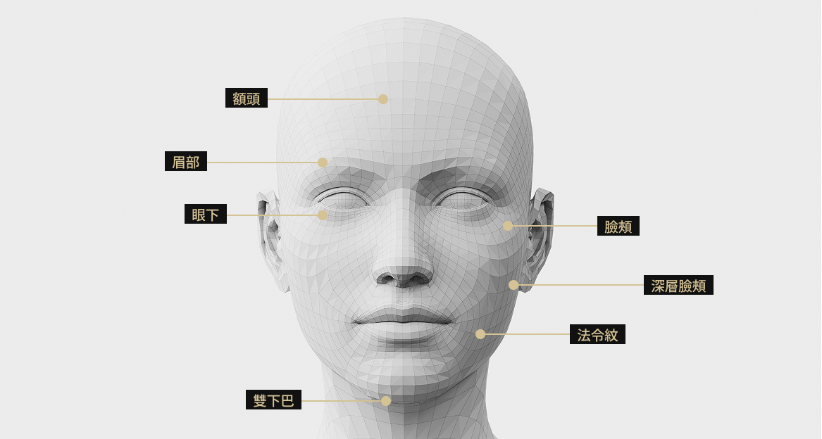 3D臉部模型影像顯示了Thermage FLX治療區域。