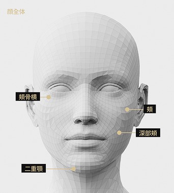 オンダリフティング適用部位を表示した3D顔モデル画像