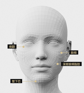 3D臉部模型影像顯示了Onda提拉術的應用區域。