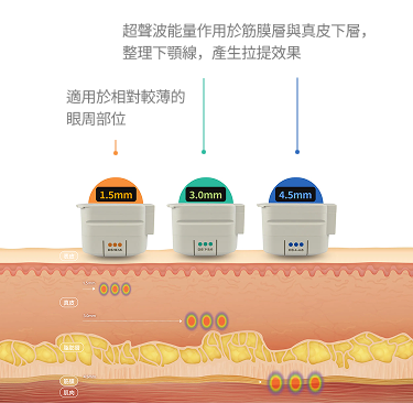 4.5mm・3.0mm・1.5mmの深さに超音波エネルギーが伝わる皮膚断面構造イメージ