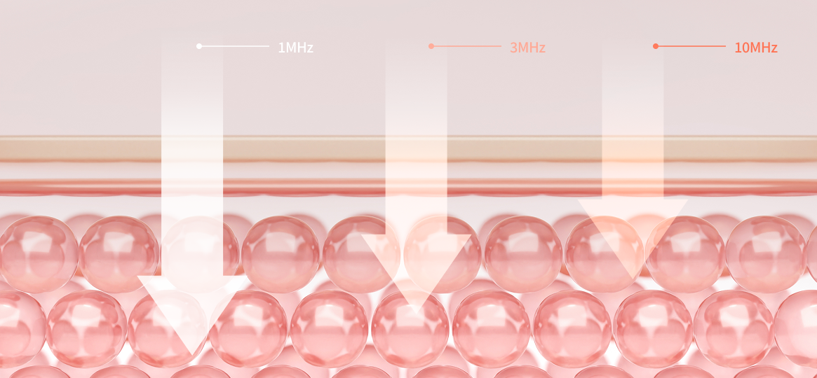 1MHz·3MHz·10MHz 초음파가 교차 작용하며 피부 재생을 촉진하는 LDM 시술 원리를 시각화한 그래픽 이미지