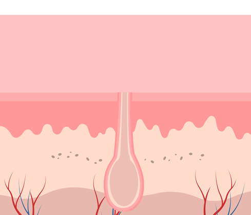 755nm 레이저가 모낭의 멜라닌에 선택적으로 작용하는 클라리티 제모 원리를 시각화한 그래픽 이미지