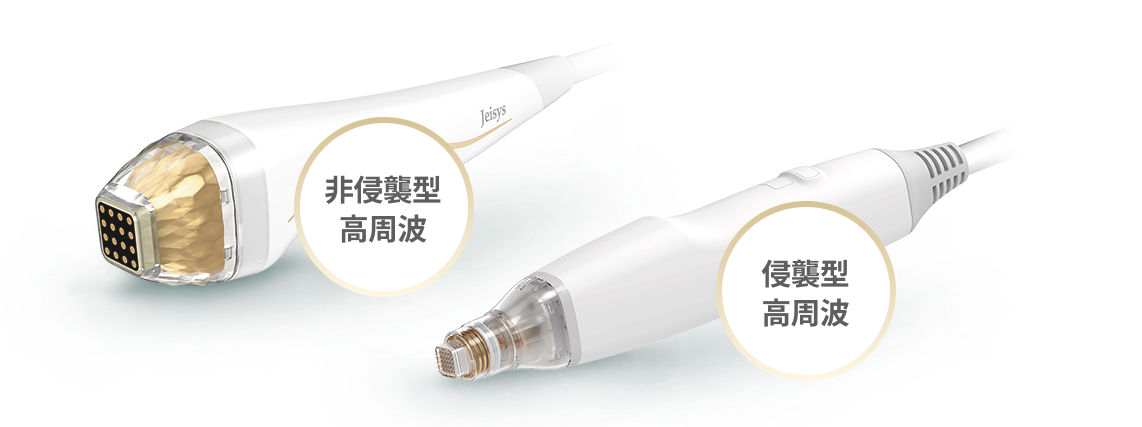 非侵襲型と侵襲型高周波手法を比較して説明するポテンザ手術型比較画像