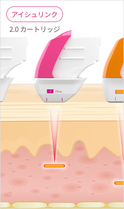 表皮層から真皮層、SMAS層までの超音波エネルギー伝達を示す皮膚構造説明画像