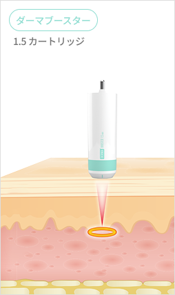 1.5mmから4.5mmまで様々なカートリッジを比較して示すシュリンクユニバースカートリッジ案内画像