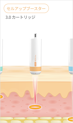 1.5mmから4.5mmまで様々なカートリッジを比較して示すシュリンクユニバースカートリッジ案内画像