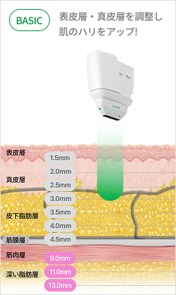 カートリッジ深さ調整で真皮層とSMAS層を精密ターゲティングするリニア構造説明画像