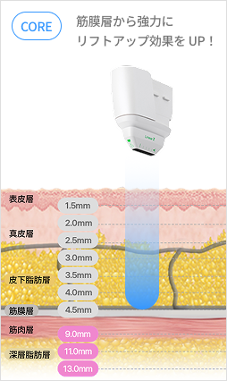 圖示超音波結構，使用深度為 9 至 13 毫米的探頭來定位特定身體部位。