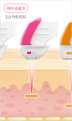 표피층부터 진피층, SMAS층까지 초음파 에너지 전달을 보여주는 피부 구조 설명 이미지