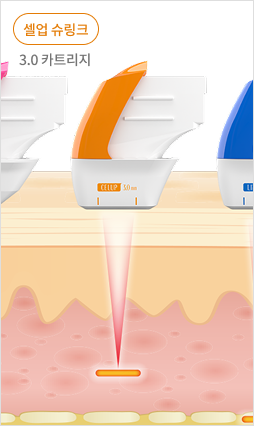 표피층부터 진피층, SMAS층까지 초음파 에너지 전달을 보여주는 피부 구조 설명 이미지