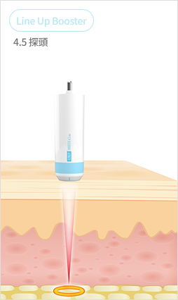 Shrink Universe 墨盒指南圖，比較了 1.5 毫米至 4.5 毫米的各種墨盒。