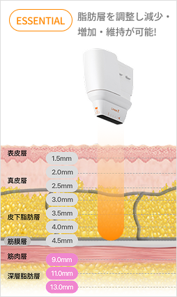 圖示超音波結構，使用深度為 9 至 13 毫米的探頭來定位特定身體部位。