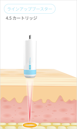 1.5mmから4.5mmまで様々なカートリッジを比較して示すシュリンクユニバースカートリッジ案内画像