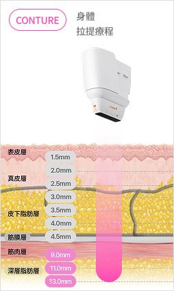 圖示超音波結構，使用深度為 9 至 13 毫米的探頭來定位特定身體部位。