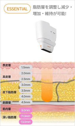 カートリッジ深さ調整で真皮層とSMAS層を精密ターゲティングするリニア構造説明画像