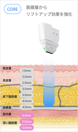 カートリッジ深さ調整で真皮層とSMAS層を精密ターゲティングするリニア構造説明画像