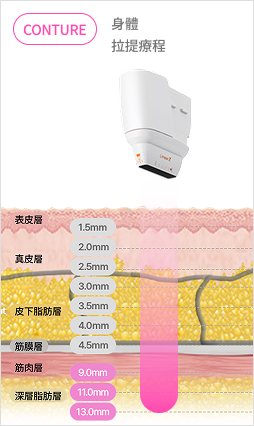 圖示說明了透過調節針頭深度，精確作用於真皮層和SMAS層的線性結構。