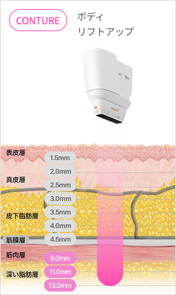 カートリッジ深さ調整で真皮層とSMAS層を精密ターゲティングするリニア構造説明画像