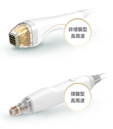 非侵襲型と侵襲型高周波手法を比較して説明するポテンザ手術型比較画像