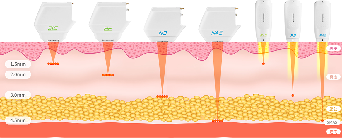FLカートリッジとSDカートリッジを含むVYリフティングカートリッジの種類を示す画像