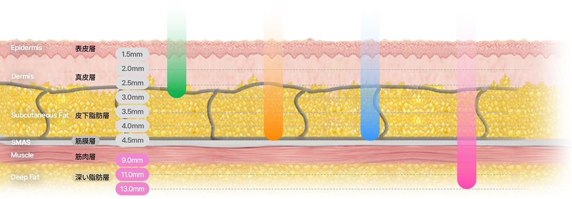 カートリッジ深さ調整で真皮層とSMAS層を精密ターゲティングするリニア構造説明画像
