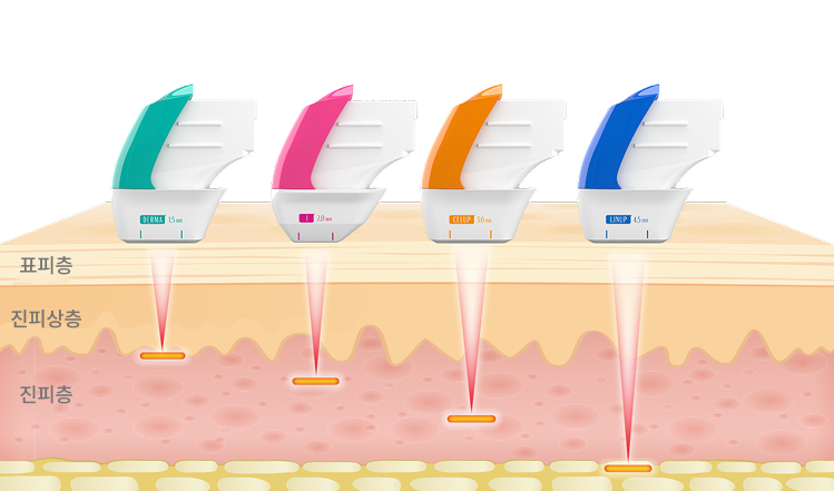 표피층부터 진피층, SMAS층까지 초음파 에너지 전달을 보여주는 피부 구조 설명 이미지