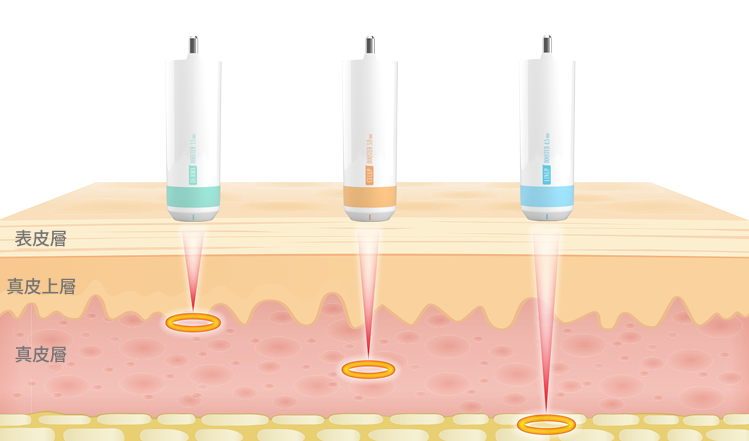 1.5mmから4.5mmまで様々なカートリッジを比較して示すシュリンクユニバースカートリッジ案内画像