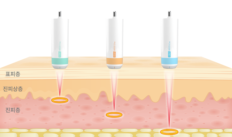 1.5mm부터 4.5mm까지 다양한 카트리지를 비교해 보여주는 슈링크 유니버스 카트리지 안내 이미지