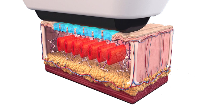 소프쿨 쿨링 시스템 설명 이미지