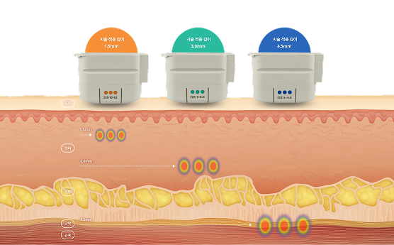 얼굴 각 부위별 피부 두께에 따른 에너지 커스터마이징 원리를 설명하는 이미지