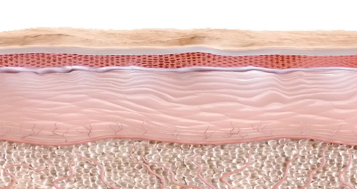 울쎄라 시술 전후 콜라겐 재생에 따른 피부 탄력 및 윤곽선 개선 비교 이미지