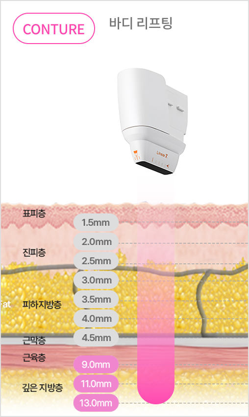 카트리지 깊이 조절로 진피층과 SMAS층을 정밀 타겟팅하는 리니어지 구조 설명 이미지
