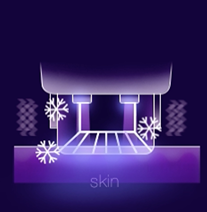 써마지 시술 스텝별 상세 이미지