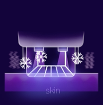 써마지 시술 스텝별 상세 이미지