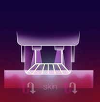 써마지 시술 스텝별 상세 이미지