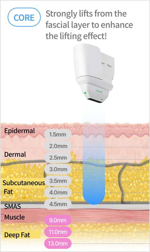 Image explaining the linear structure that precisely targets the dermis and SMAS layers by adjusting the cartridge depth.