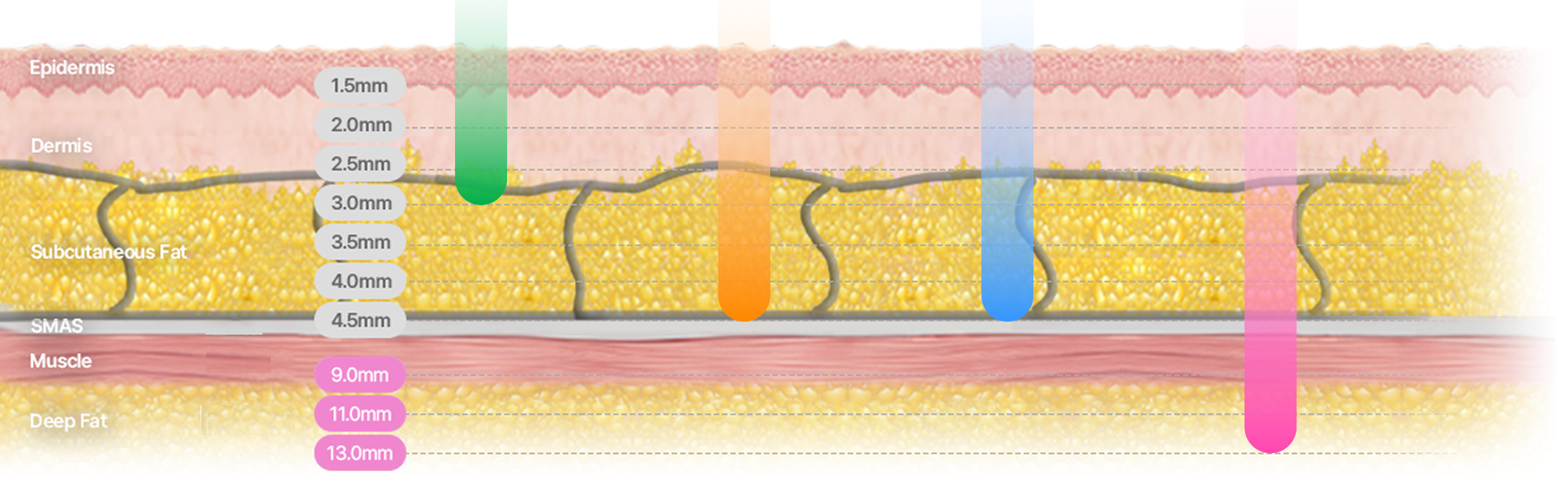 Image explaining the linear structure that precisely targets the dermis and SMAS layers by adjusting the cartridge depth.