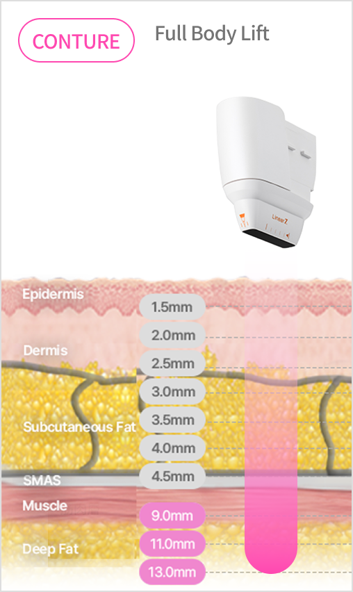 Image illustrating the ultrasound structure that uses a cartridge with a depth of 9 to 13 mm to target specific body parts.
