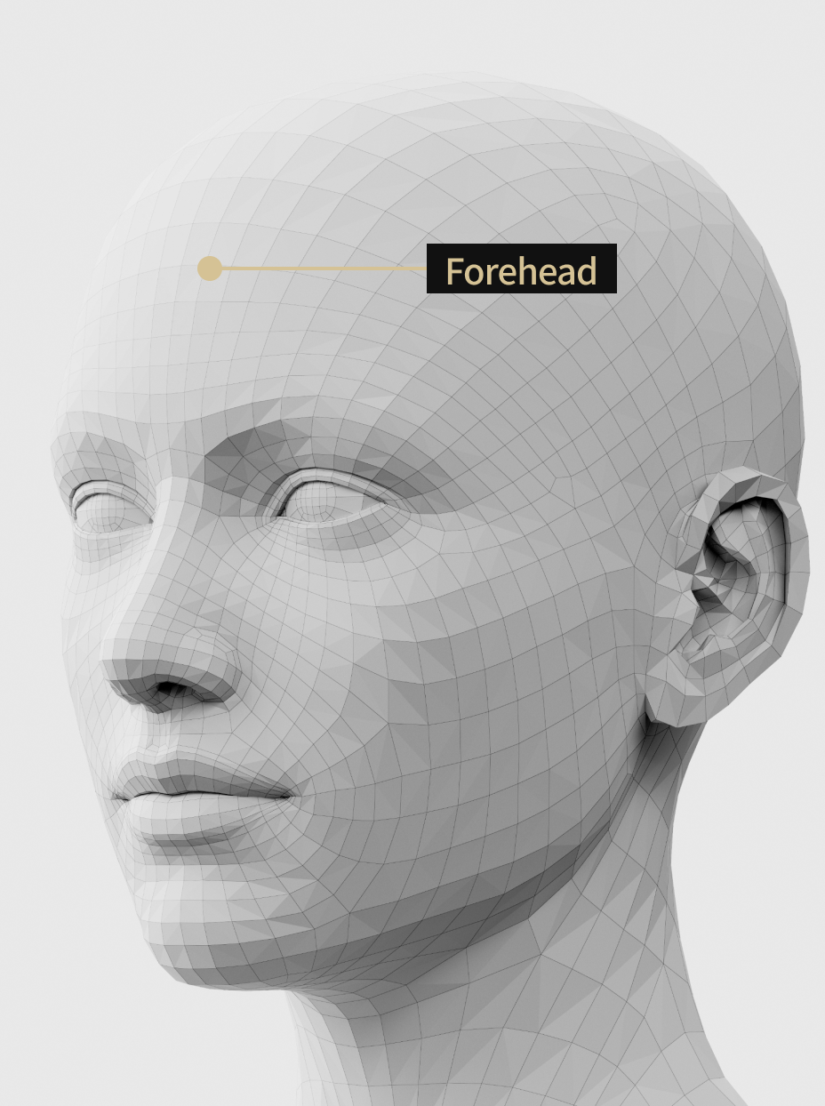 Image description of forehead filler treatment that adds volume to the forehead to create a three-dimensional impression.