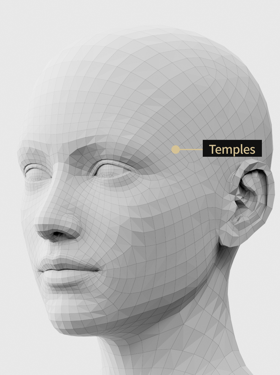 Image of temple filler treatment to improve temple sagging and smooth facial balance.